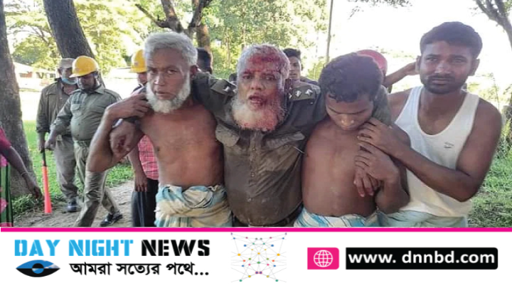 রামুতে বন রক্ষা করতে গিয়ে জবরদখলকারীর হামলায় ২৮ বনকর্মী আহত