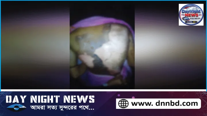 শিমগাছ খাওয়া নিয়ে বিরোধে গরম মাড়ে নারীকে ঝলসে দিলেন স্বজনরা