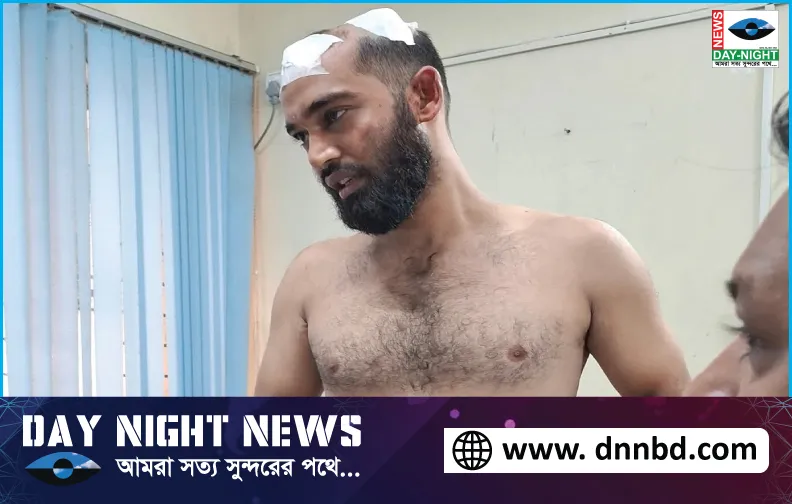 কোম্পানীগঞ্জে,  বাসে বেশি ভাড়া নেওয়ার,  প্রতিবাদ করায়,  মাথা ফাটালো যাত্রীর