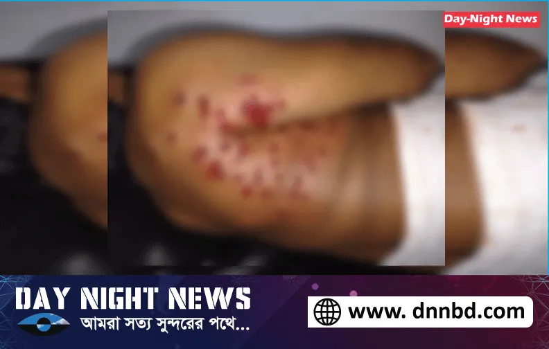 নোয়াখালীতে মোটরসাইকেল ছিনতাই করতে মাদরাসা শিক্ষককে গুলি 