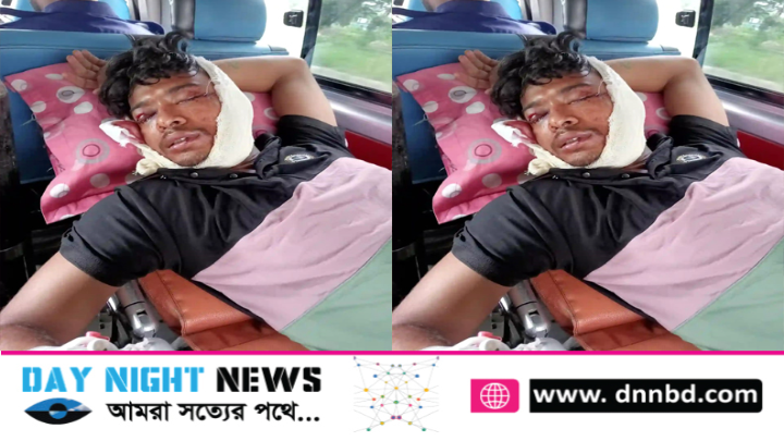 কারাগারে ঘুমের ভিতর হাজতির ২ চোখ নষ্ট করে দিল কয়েদী 