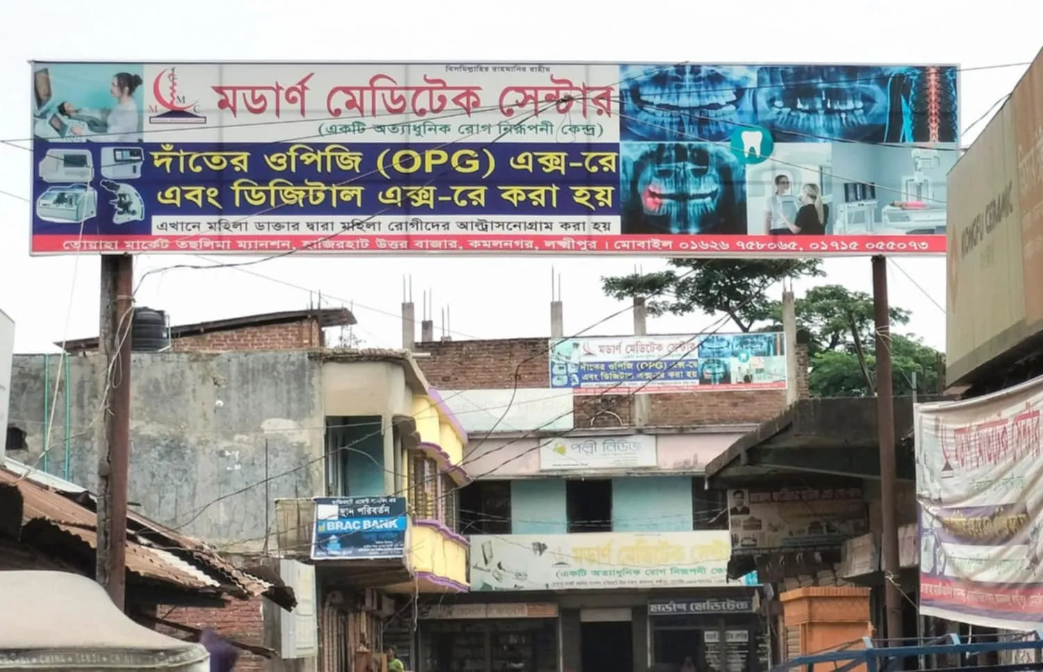কমলনগরে,  লাইসেন্স ছাড়াই, চলছে ৪টি, ডায়াগনস্টিক সেন্টার