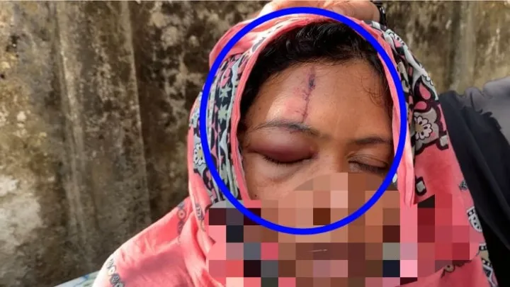 কুমিল্লা ‎চৌদ্দগ্রামে জায়গা সংক্রান্ত বিরোধ নিয়ে হামলা. প্রতিবন্ধী শিশুসহ আহত ৬