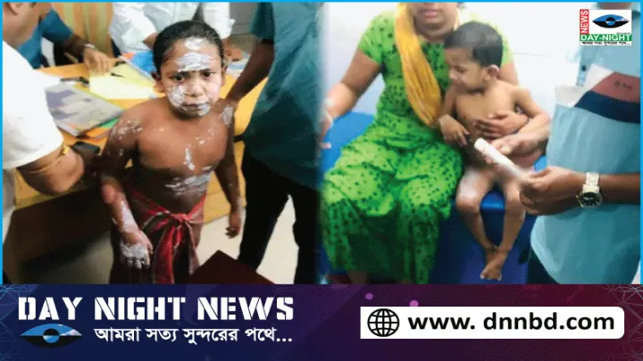 নোয়াখালীতে গ্যাস লিকেজ থেকে বিস্ফোরণে একই পরিবারের ৪জন দগ্ধ