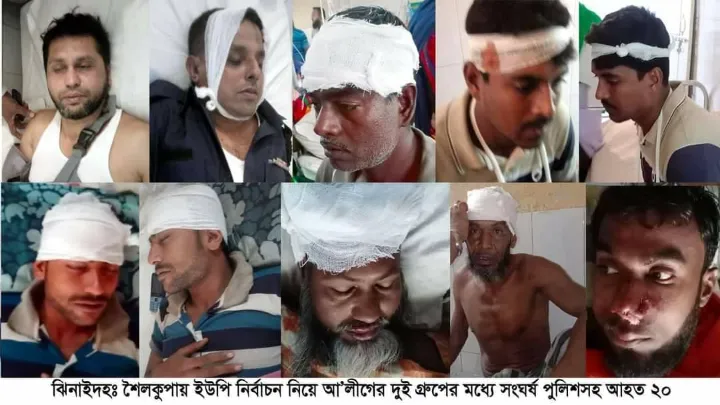 ঝিনাইদহে নির্বাচন নিয়ে আ’লীগের দুই গ্রুপের সংঘর্ষ  পুলিশসহ আহত ২০